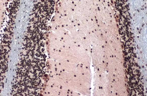 Immunohistochemistry-Paraffin TOP2B Antibody