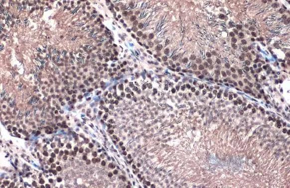 Immunohistochemistry-Paraffin TOP2B Antibody