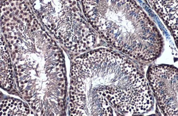 Immunohistochemistry-Paraffin TOP2B Antibody