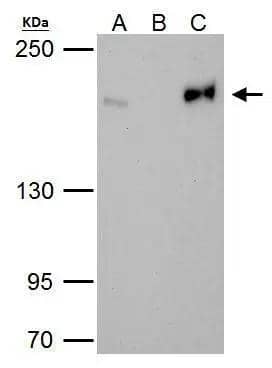Immunoprecipitation TOP2B Antibody