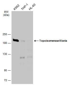 Western Blot TOP2B Antibody
