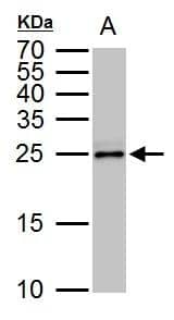 TPPP antibody detects TPPP protein by western blot analysis.A. 50 ug rat brain lysate/extract15 % SDS-PAGETPPP antibody (NBP2-20688) dilution: 1:1000 