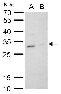 TPPP antibody detects TPPP protein by western blot analysis.A. 30 ug PC-12 whole cell lysate/extract B. 30 ug Rat2 whole cell lysate/extract12 % SDS-PAGETPPP antibody (NBP2-20688) dilution: 1:20000 