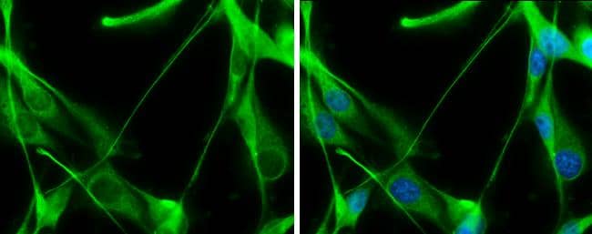 Transaldolase antibody [N2C3] detects Transaldolase protein at cytoplasm by immunofluorescent analysis.Sample: U87-MG cells were fixed in 4% paraformaldehyde at RT for 15 min.Green: Transaldolase stained by Transaldolase antibody [N2C3] (NBP2-20695) diluted at 1:500.Blue: Hoechst 33342 staining. 