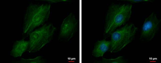 Immunocytochemistry/ Immunofluorescence transgelin 2 Antibody