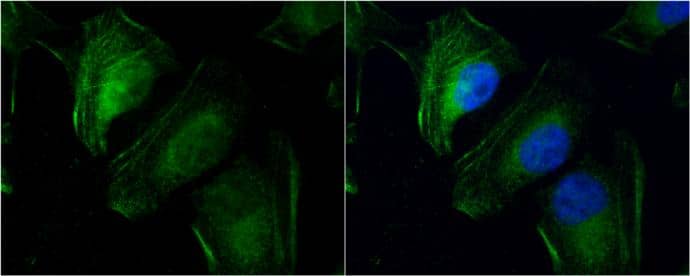 Immunocytochemistry/ Immunofluorescence transgelin 2 Antibody