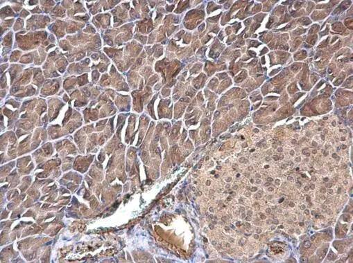 Immunohistochemistry-Paraffin transgelin 2 Antibody