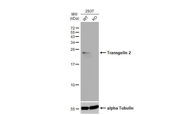 Western Blot transgelin 2 Antibody