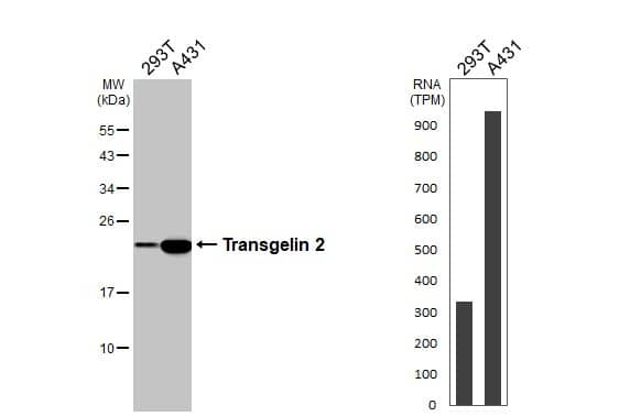 Western Blot transgelin 2 Antibody