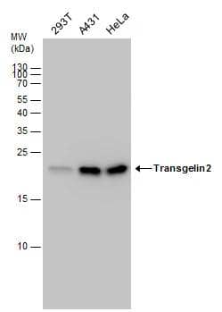 Western Blot transgelin 2 Antibody