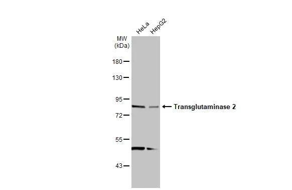Various whole cell extracts (30 ug) were separated by 7.5% SDS-PAGE, and the membrane was blotted with Transglutaminase 2 antibody [N1N3] (NBP2-20698) diluted at 1:2000. The HRP-conjugated anti-rabbit IgG antibody  was used to detect the primary antibody. 