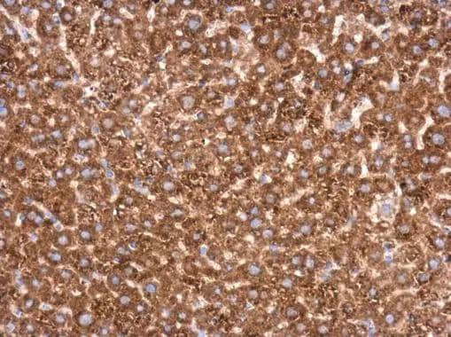 Immunohistochemistry-Paraffin Transketolase Antibody