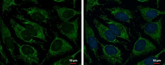 TRAP1 antibody [N1N3] detects TRAP1 protein at mitochondria by immunofluorescent analysis.Sample: HeLa cells were fixed in 2% paraformaldehyde/culture medium at 37oC for 30 min and permeabilized with 100% MeOH for 30 sec.Green: TRAP1 protein stained by TRAP1 antibody [N1N3] (NBP2-20700) diluted at 1:500.Blue: Hoechst 33342 staining.Scale bar = 10 um. 