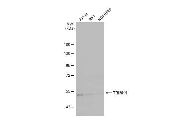 Western Blot: Trim11 Antibody [NBP2-20705] - Various whole cell extracts (30 ug) were separated by 7.5% SDS-PAGE, and the membrane was blotted with Trim11 antibody [N3C3] (NBP2-20705) diluted at 1:8000. The HRP-conjugated anti-rabbit IgG antibody  was used to detect the primary antibody.