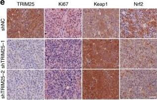 Immunohistochemistry: TRIM25 Antibody [NBP2-20710] - Knockdown of TRIM25 in HCC suppresses tumor growth in nude mice.a–c Huh7 cells stably expressing the indicated shRNAs (shNC, shTRIM25-1 & shTRIM25-2) were subcutaneously injected in nude mice respectively. Shown are average tumor volumes over time (n = 8) (a) & representative image (b) & weights (c) of tumors at day 25. d Kaplan–Meier analysis of overall survival percentage in nude mice inoculated with Huh7-shNC or Huh7-shTRIM25. The statistical significance was assessed using two-sided log-rank test according to mice with depletion of control or TRIM25. e, f Representative images (e) of IHC staining & the relative IHC scores (n = 8) (f) of TRIM25, Ki67, Keap1 & Nrf2 in HCC tissues of mice inoculated with Huh7-shNC or Huh7-shTRIM25-1&-2. Scale bar, 50 μm. g, h Representative IHC staining images (g) & statistical data (h) of TRIM25, Keap1 & Nrf2 expression in HCC tissues (TRIM25 low expression group, n = 45 & TRIM25 high expression group, n = 45). Scale bar, 50 μm. For a, c, f, & h, data represent the mean ± SEM. Statistical significance was assessed using two-tailed Student’s t-tests. Image collected & cropped by CiteAb from the following publication (//pubmed.ncbi.nlm.nih.gov/31953436), licensed under a CC-BY license. Not internally tested by Novus Biologicals.