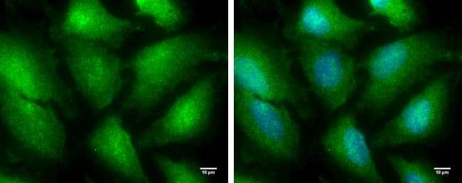 TRIM25 antibody detects TRIM25 protein at cytoplasm and nucleus by immunofluorescent analysis.Sample: HeLa cells were fixed in 4% paraformaldehyde for 10 min.Green: TRIM25 protein stained by TRIM25 antibody (NBP2-20710) diluted at 1:100.Blue: Hoechst 33342 staining.Scale bar = 10 um. 