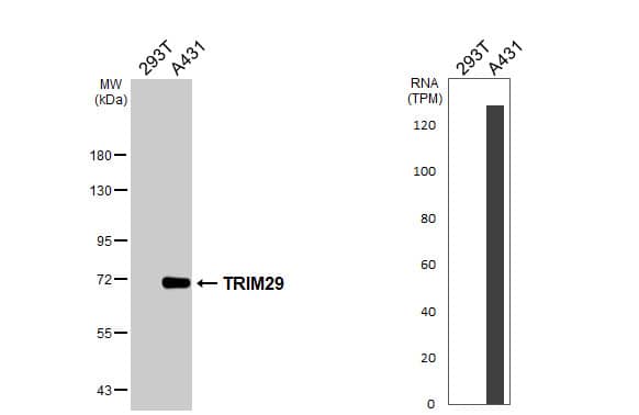 Various whole cell extracts (30 ug) were separated by 7.5% SDS-PAGE, and the membrane was blotted with TRIM29 antibody [C1C3] (NBP2-20713) diluted at 1:1000. The HRP-conjugated anti-rabbit IgG antibody  was used to detect the primary antibody. Corresponding RNA expression data are based on Human Protein Atlas program. 