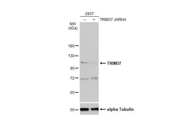 <b>Genetic Strategies Validation. </b>Non-transfected (-) and transfected (+) 293T whole cell extracts (30 ug) were separated by 7.5% SDS-PAGE, and the membrane was blotted with TRIM37 antibody [N1N2], N-term (NBP2-20715) diluted at 1:1000. The HRP-conjugated anti-rabbit IgG antibody  was used to detect the primary antibody, and the signal was developed with Trident ECL plus-Enhanced. 