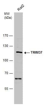Whole cell extract (30 ug) was separated by 7.5% SDS-PAGE, and the membrane was blotted with TRIM37 antibody [N1N2], N-term (NBP2-20715) diluted at 1:500. The HRP-conjugated anti-rabbit IgG antibody  was used to detect the primary antibody. 