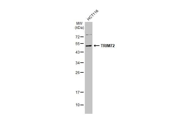 Whole cell extract (30 ug) was separated by 12% SDS-PAGE, and the membrane was blotted with TRIM72 antibody (NBP2-20725) diluted at 1:1000. The HRP-conjugated anti-rabbit IgG antibody  was used to detect the primary antibody. 