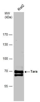 Western Blot: TRIOBP Antibody [NBP2-20726] - Whole cell extract (30 ug) was separated by 7.5% SDS-PAGE, and the membrane was blotted with TRIOBP antibody [C2C3-2], C-term (NBP2-20726) diluted at 1:5000. The HRP-conjugated anti-rabbit IgG antibody  was used to detect the primary antibody.