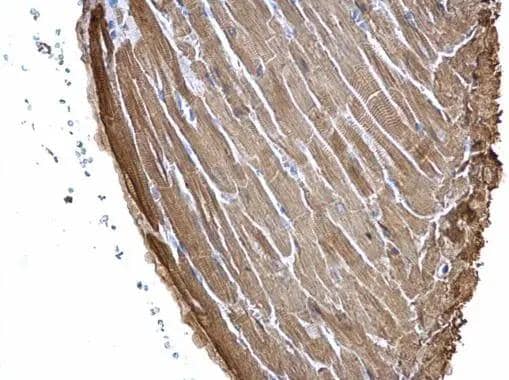 Cardiac Troponin I antibody [N1C3] detects Cardiac Troponin I protein at cytosol on mouse heart by immunohistochemical analysis. Sample: Paraffin-embedded mouse heart. Cardiac Troponin I antibody [N1C3] (NBP2-20734) dilution: 1:500.Scale bar = M um. br>Antigen Retrieval: Trilogy(TM) (EDTA based, pH 8.0) buffer, 15min 