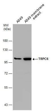 A549 whole cell and membrane extracts (30 ug) were separated by 7.5% SDS-PAGE, and the membrane was blotted with TRPC6 antibody (NBP2-20737) diluted at 1:1000. 