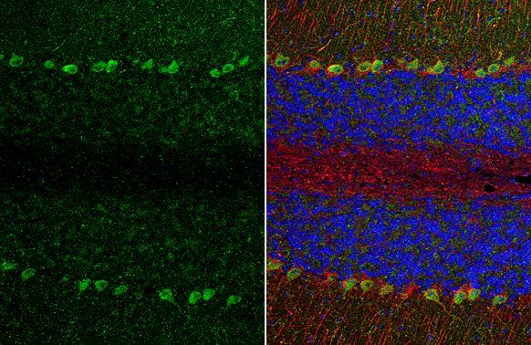 TRPC6 antibody [N1N3] detects TRPC6 protein at cytoplasm by immunohistochemical analysis.Sample: Paraffin-embedded mouse cerebellum.Green: TRPC6 stained by TRPC6 antibody [N1N3] (NBP2-20738) diluted at 1:500.Red: NF-H, a neuron marker, stained by NF-H antibody [GT114]  diluted at 1:500.Blue: Fluoroshield with DAPI .Antigen Retrieval: Citrate buffer, pH 6.0, 15 min 