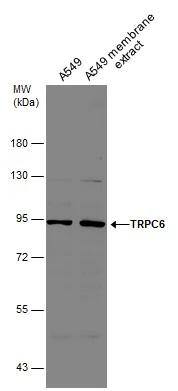 A549 whole cell and membrane extracts (30 ug) were separated by 7.5% SDS-PAGE, and the membrane was blotted with TRPC6 antibody (NBP2-20738) diluted at 1:1000. 