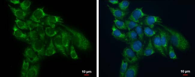 Immunocytochemistry/ Immunofluorescence TSFM Antibody