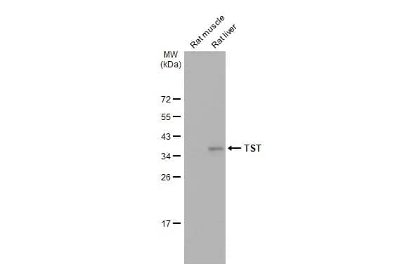 Western Blot: TST Antibody [NBP2-20752] - Various tissue extracts (50 ug) were separated by 12% SDS-PAGE, and the membrane was blotted with TST antibody (NBP2-20752) diluted at 1:3000. The HRP-conjugated anti-rabbit IgG antibody  was used to detect the primary antibody.