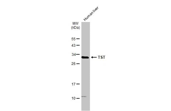 Western Blot: TST Antibody [NBP2-20752] - Human tissue extract (50 ug) was separated by 12% SDS-PAGE, and the membrane was blotted with TST antibody (NBP2-20752) diluted at 1:3000. The HRP-conjugated anti-rabbit IgG antibody  was used to detect the primary antibody.