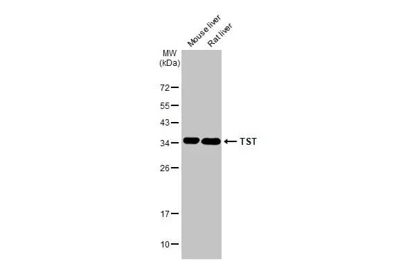 Western Blot: TST Antibody [NBP2-20752] - Various tissue extracts (50 ug) were separated by 12% SDS-PAGE, and the membrane was blotted with TST antibody (NBP2-20752) diluted at 1:1000. The HRP-conjugated anti-rabbit IgG antibody  was used to detect the primary antibody.