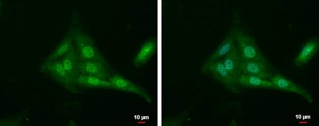 Tub antibody detects Tub protein at cytoplasm and nucleus by immunofluorescent analysis.Sample: SKNSH cells were fixed in 4% paraformaldehyde at RT for 15 min.Green: Tub protein stained by Tub antibody (NBP2-20758) diluted at 1:500.Blue: Hoechst 33342 staining.Scale bar = 10 um. 