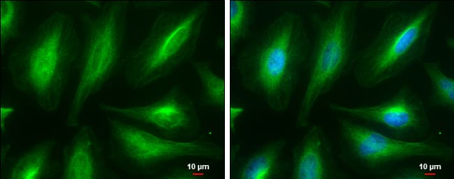 Immunocytochemistry/ Immunofluorescence: Tubulin alpha-1B Antibody [NBP2-20759] - Tubulin alpha-1B antibody detects Tubulin alpha-1B protein at cytoskeleton by immunofluorescent analysis.Sample: HeLa cells were fixed in 4% paraformaldehyde at RT for 15 min.Green: Tubulin alpha-1B protein stained by Tubulin alpha-1B antibody (NBP2-20759) diluted at 1:1000.Blue: Hoechst 33342 staining.Scale bar = 10 um.