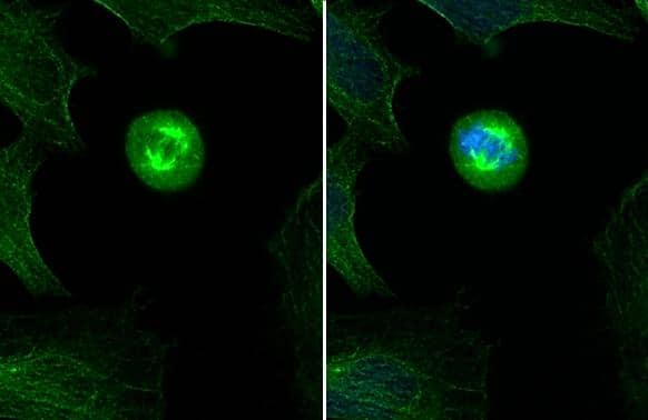 Immunocytochemistry/ Immunofluorescence Tubulin alpha-1B Antibody