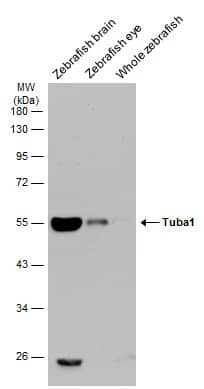 Western Blot: Tubulin alpha-1B Antibody [NBP2-20761] - Various tissue extracts (30 ug) were separated by 10% SDS-PAGE, and the membrane was blotted with Tubulin alpha-1B antibody (NBP2-20761) diluted at 1:1000. The HRP-conjugated anti-rabbit IgG antibody  was used to detect the primary antibody.