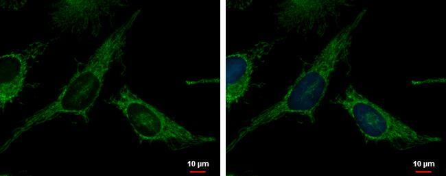TrxR2 antibody detects TrxR2 protein at mitochondria by immunofluorescent analysis.Sample: HeLa cells were fixed in 2% paraformaldehyde/culture medium at 37C for 30 min.Green: TrxR2 protein stained by TrxR2 antibody (NBP2-20768) diluted at 1:500.Blue: Hoechst 33342 staining. 