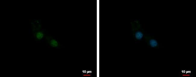 U1SNRNPBP antibody [N2C3] detects U1SNRNPBP protein at nucleus by immunofluorescent analysis.Sample: U87-MG cells were fixed in 4% paraformaldehyde at RT for 15 min.Green: U1SNRNPBP protein stained by U1SNRNPBP antibody [N2C3] (NBP2-20774) diluted at 1:500.Blue: Hoechst 33342 staining. 