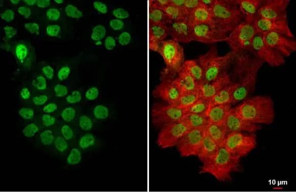 Immunocytochemistry/ Immunofluorescence: U2AF2 Antibody [NBP2-20775] - U2AF2 antibody [C1C3] detects U2AF2 protein at nucleus by immunofluorescent analysis.Sample: A431 cells were fixed in 4% paraformaldehyde at RT for 15 min.Green: U2AF2 stained by U2AF2 antibody [C1C3] (NBP2-20775) diluted at 1:500.Red: alpha Tubulin, a cytoskeleton marker, stained by alpha Tubulin antibody [GT114]  diluted at 1:1000.