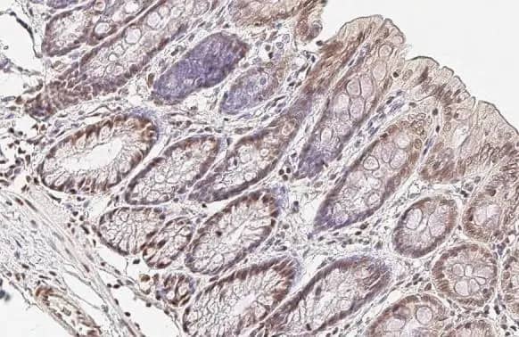 Immunohistochemistry-Paraffin: U2AF2 Antibody [NBP2-20775] - U2AF2 antibody [C1C3] detects U2AF2 protein at cytoplasm and nucleus by immunohistochemical analysis.Sample: Paraffin-embedded rat colon.U2AF2 stained by U2AF2 antibody [C1C3] (NBP2-20775) diluted at 1:500.Antigen Retrieval: Citrate buffer, pH 6.0, 15 min