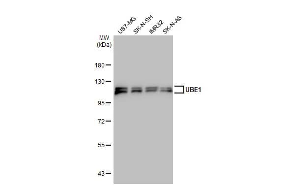 Western Blot: Ubiquitin-activating Enzyme/UBE1 Antibody [NBP2-20779] - Various whole cell extracts (30 ug) were separated by 7.5% SDS-PAGE, and the membrane was blotted with Ubiquitin-activating Enzyme/UBE1 antibody [N1N3] (NBP2-20779) diluted at 1:10000. The HRP-conjugated anti-rabbit IgG antibody  was used to detect the primary antibody.