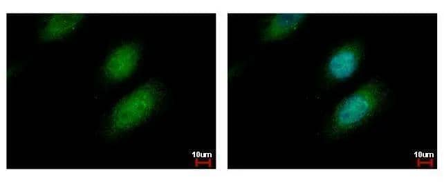 UBE2A antibody detects UBE2A protein at cytoplasm and nucleus by immunofluorescent analysis. Sample: HeLa cells were fixed in 4% paraformaldehyde at RT for 15 min.Green: UBE2A protein stained by UBE2A antibody (NBP2-20780) diluted at 1:500.Blue: Hoechst 33342 staining. 