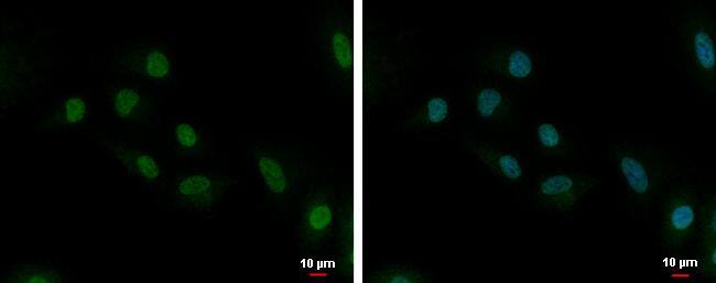 UBE2C antibody [N1C3] detects UBE2C protein at cytoplasm and nucleus by immunofluorescent analysis.Sample: A549 cells were fixed in 4% paraformaldehyde at RT for 15 min.Green: UBE2C protein stained by UBE2C antibody [N1C3] (NBP2-20782) diluted at 1:500.Blue: Hoechst 33342 staining.Scale bar = 10 um. 