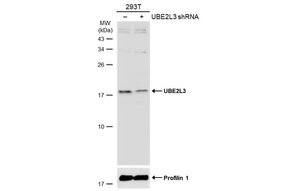 <b>Genetic Strategies Validation. </b>Non-transfected (-) and transfected (+) 293T whole cell extracts (30 ug) were separated by 15% SDS-PAGE, and the membrane was blotted with UBE2L3 antibody [N1C3] (NBP2-20786) diluted at 1:1000. The HRP-conjugated anti-rabbit IgG antibody  was used to detect the primary antibody. 