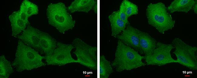 USP8 antibody detects USP8 protein at cytoplasm by immunofluorescent analysis.Sample: A549 cells were fixed in 4% paraformaldehyde at RT for 15 min.Green: USP8 protein stained by USP8 antibody (NBP2-20792) diluted at 1:500.Blue: Hoechst 33342 staining. 