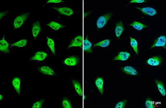 Immunocytochemistry/ Immunofluorescence: UDP glucose dehydrogenase Antibody [NBP2-20798] - UDP glucose dehydrogenase antibody detects UDP glucose dehydrogenase  protein at nucleus by immunofluorescent analysis.Sample: HeLa cells were fixed in 4% paraformaldehyde at RT for 15 min.Green: UDP glucose dehydrogenase  stained by UDP glucose dehydrogenase antibody (NBP2-20798) diluted at 1:500.