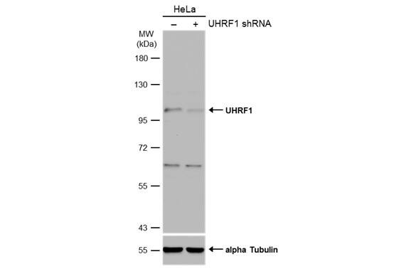 <b>Genetic Strategies Validation. </b>Non-transfected (-) and transfected (+) HeLa whole cell extracts (50 ug) were separated by 7.5% SDS-PAGE, and the membrane was blotted with UHRF1 antibody (NBP2-20806) diluted at 1:500. The HRP-conjugated anti-rabbit IgG antibody  was used to detect the primary antibody. 