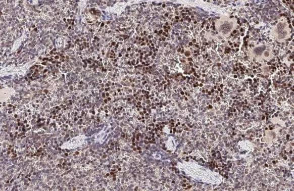 Immunohistochemistry-Paraffin: UHRF1 Antibody [NBP2-20807] - UHRF1 antibody detects UHRF1 protein at nucleus by immunohistochemical analysis.Sample: Paraffin-embedded mouse spleen.UHRF1 stained by UHRF1 antibody (NBP2-20807) diluted at 1:500.Antigen Retrieval: Citrate buffer, pH 6.0, 15 min