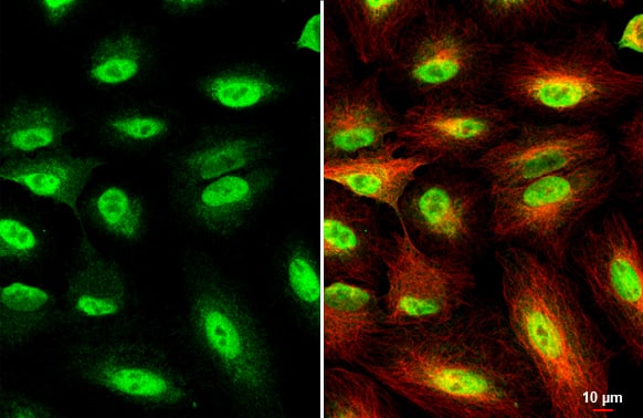 Immunocytochemistry/ Immunofluorescence: UHRF1 Antibody [NBP2-20807] - UHRF1 antibody detects UHRF1 protein at cytoplasm and nucleus by immunofluorescent analysis.Sample: A549 cells were fixed in 4% paraformaldehyde at RT for 15 min.Green: UHRF1 stained by UHRF1 antibody (NBP2-20807) diluted at 1:1000.Red: alpha Tubulin, a cytoskeleton marker, stained by alpha Tubulin antibody [GT114]  diluted at 1:1000.